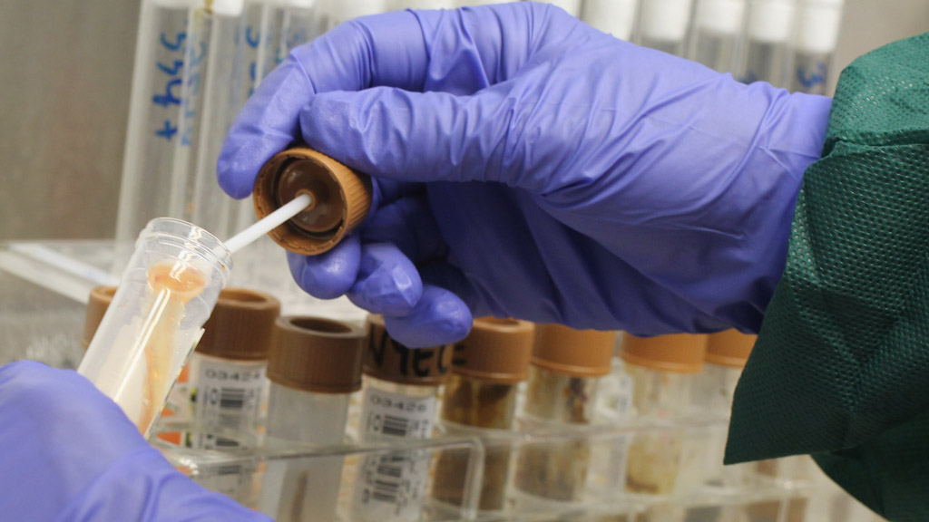 Q and A What is E.coli? Channel 4 News