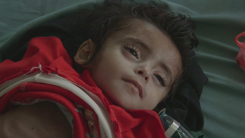 Millions facing starvation in Yemen – Channel 4 News