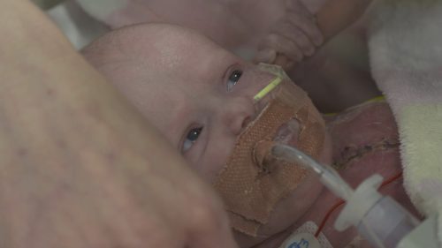 ‘Miracle’ baby survives after being born with heart outside body ...