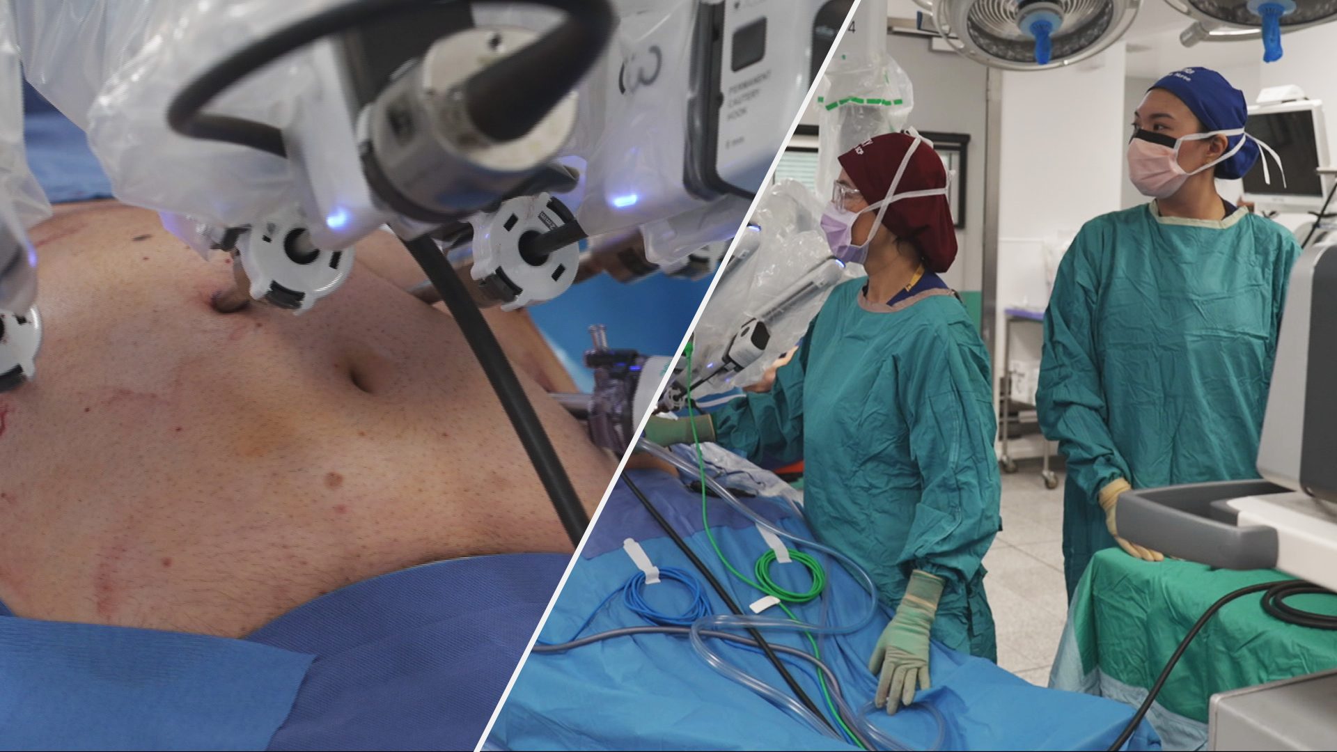 Watch as doctors perform revolutionary robot-assisted surgery